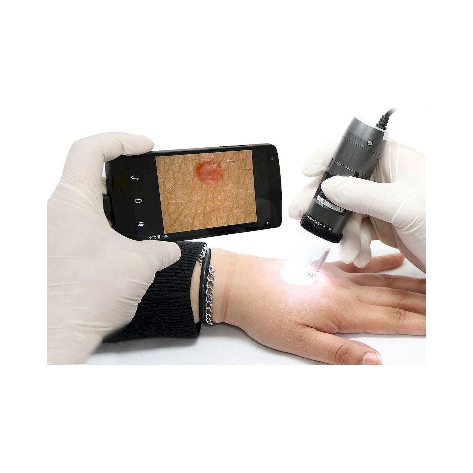 Capillaroscope 1.3 MP 500x with Polarizer Nailfold Capillaroscopy - Dino-Lite MEDL4N5