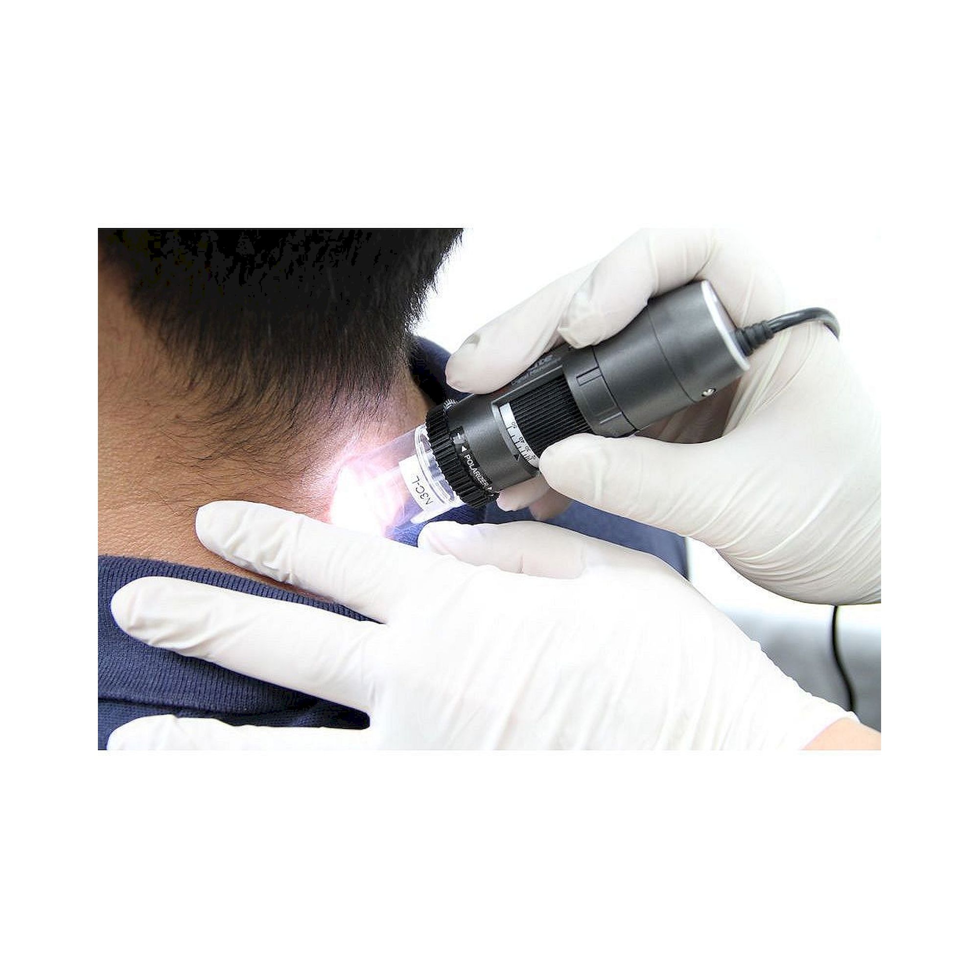 Capillaroscope 1.3 MP 500x with Polarizer Nailfold Capillaroscopy - Dino-Lite MEDL4N5
