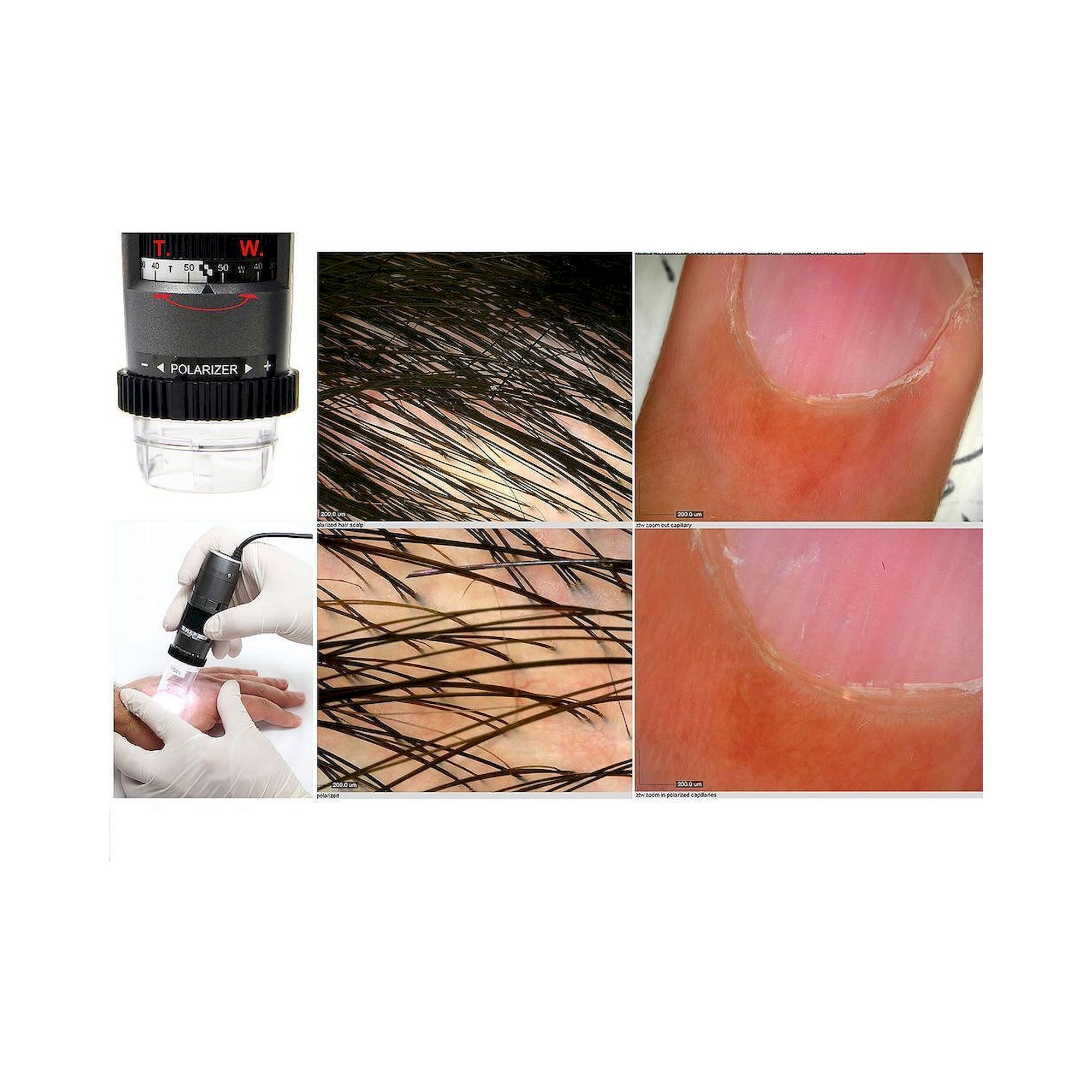 Capillaroscope 1.3 MP 500x with Polarizer Nailfold Capillaroscopy - Dino-Lite MEDL4N5