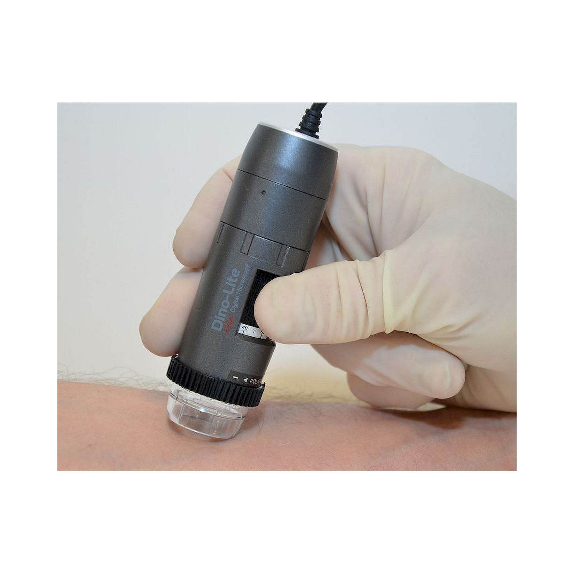 Capillaroscope 1.3 MP 500x with Polarizer Nailfold Capillaroscopy - Dino-Lite MEDL4N5