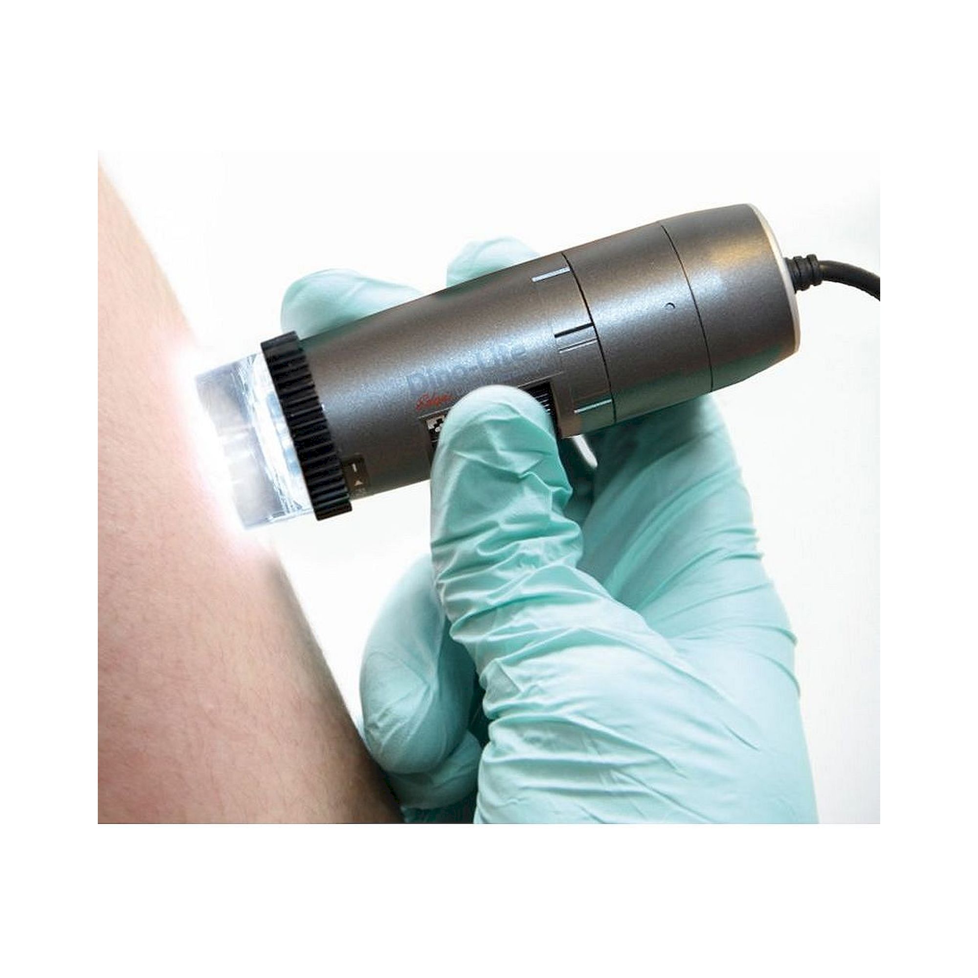 Capillaroscope 1.3 MP 500x with Polarizer Nailfold Capillaroscopy - Dino-Lite MEDL4N5