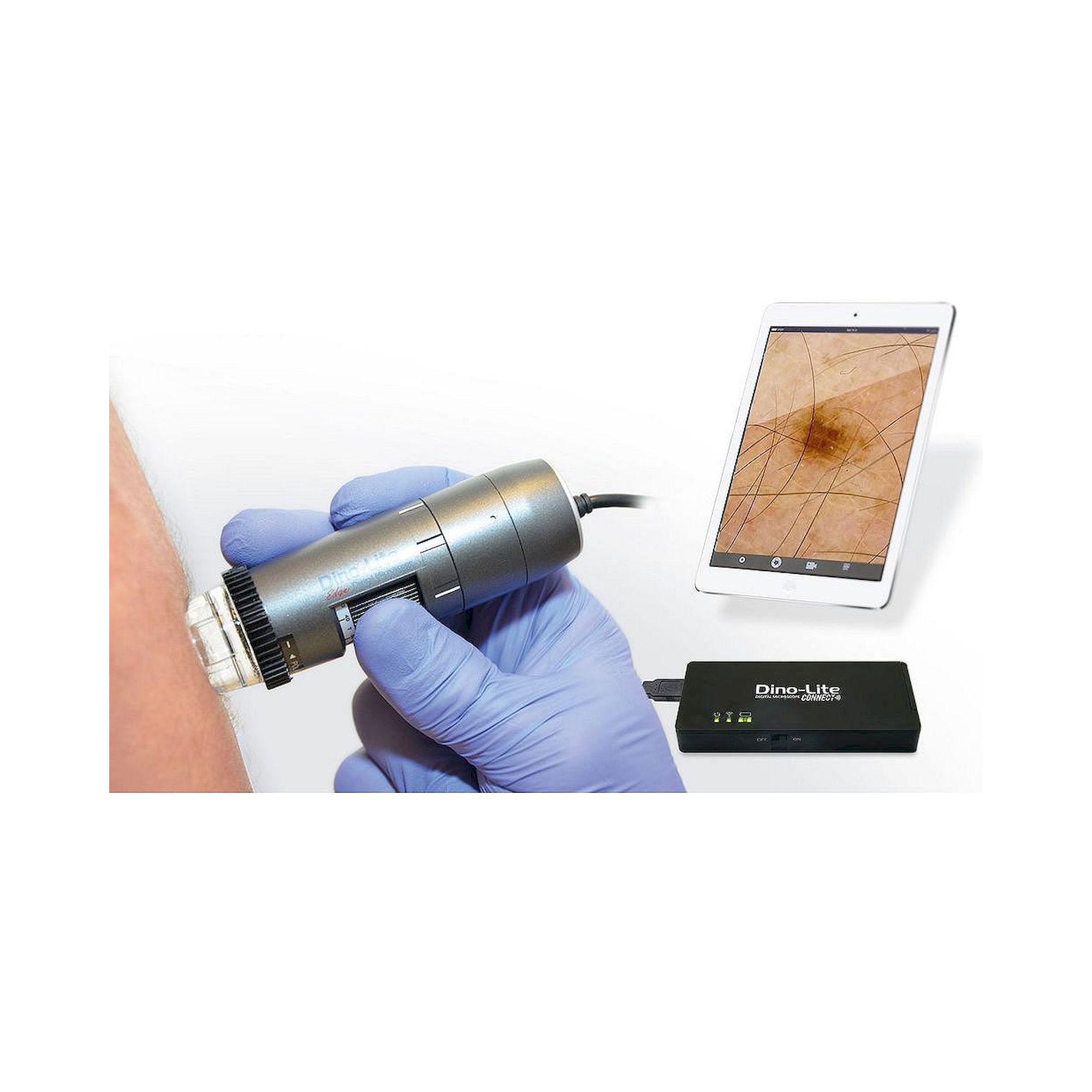 Capillaroscope 1.3 MP 500x with Polarizer Nailfold Capillaroscopy - Dino-Lite MEDL4N5