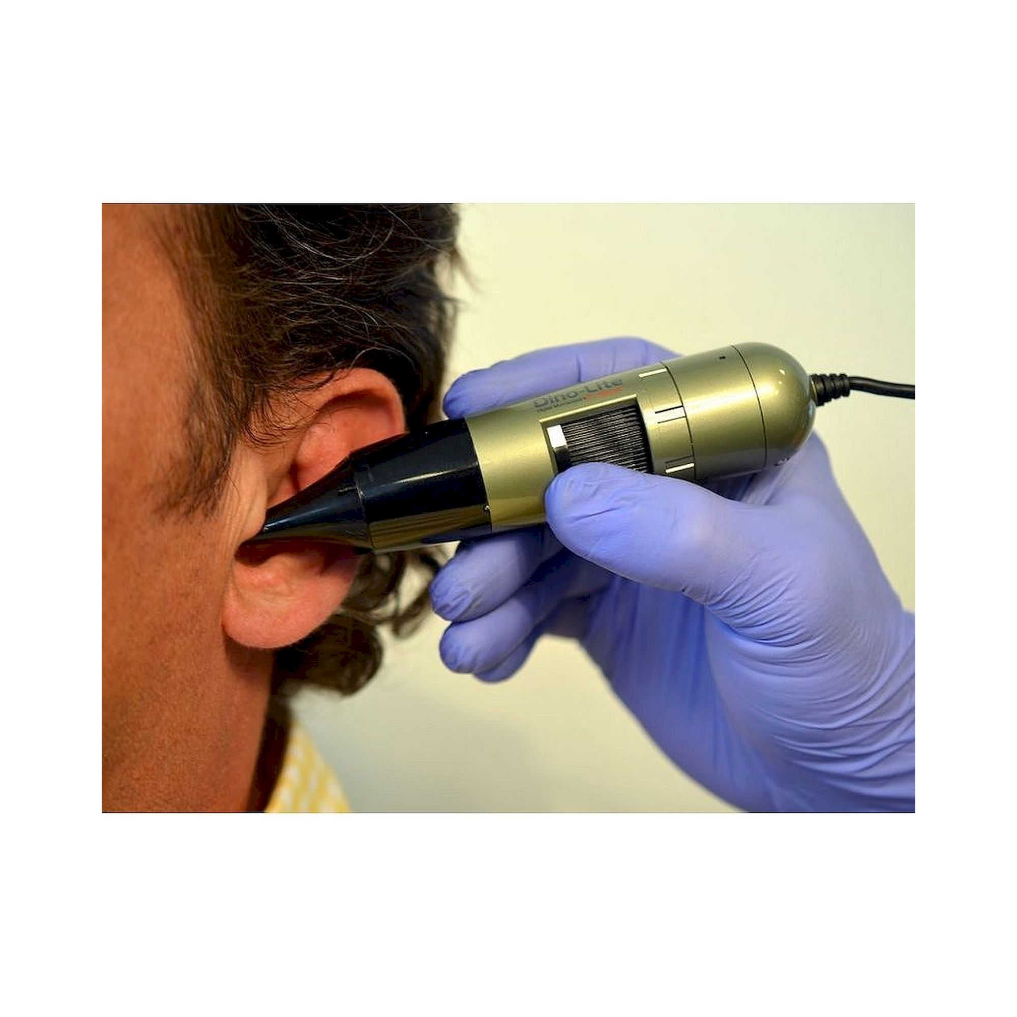 Dino-Lite EarScope Pro