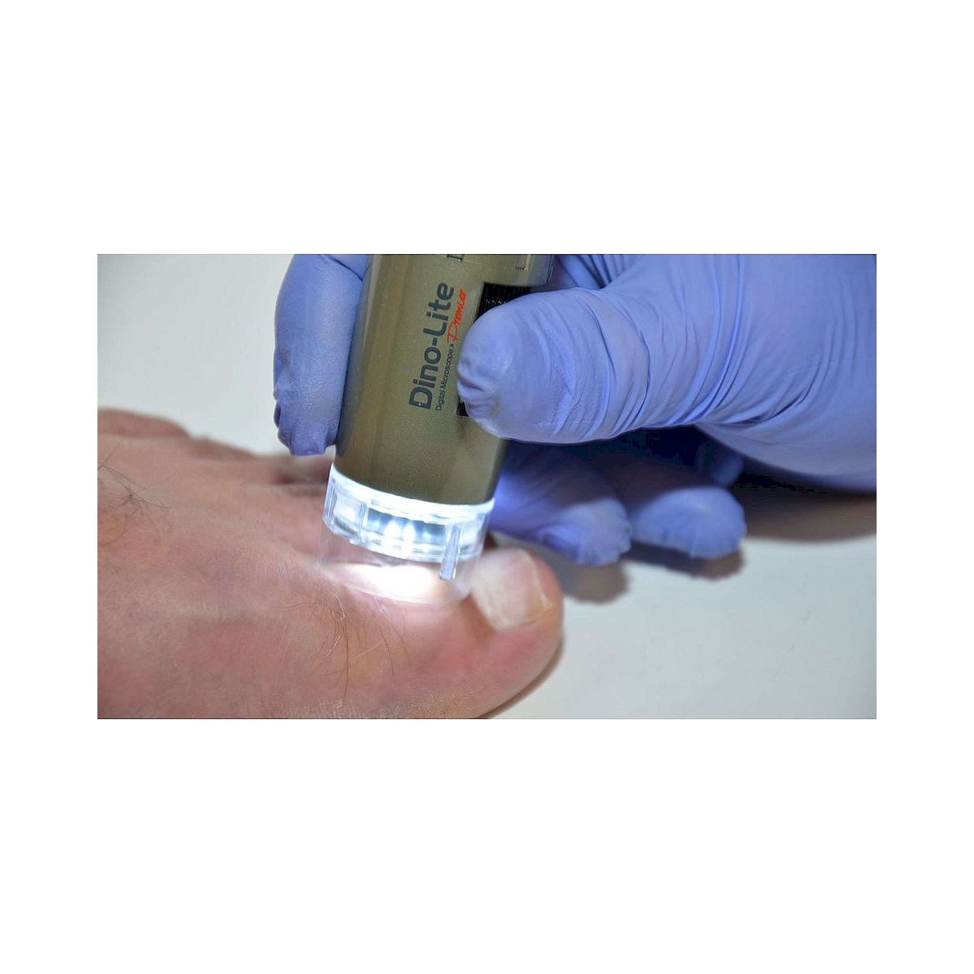 Podoscope Camera USB 1.3 MP 10-50x with Polarizer for Podiatry - Dino-Lite PodoScope
