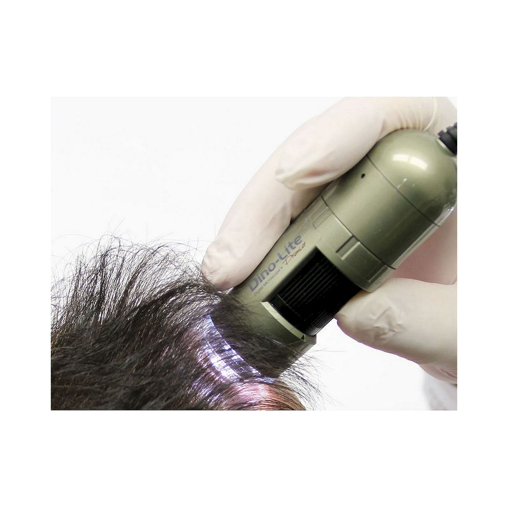 Trichoscope Camera USB 1.3 MP 10-200x with Polarizer Trichoscopy - Dino-Lite TrichoScope Polarizer