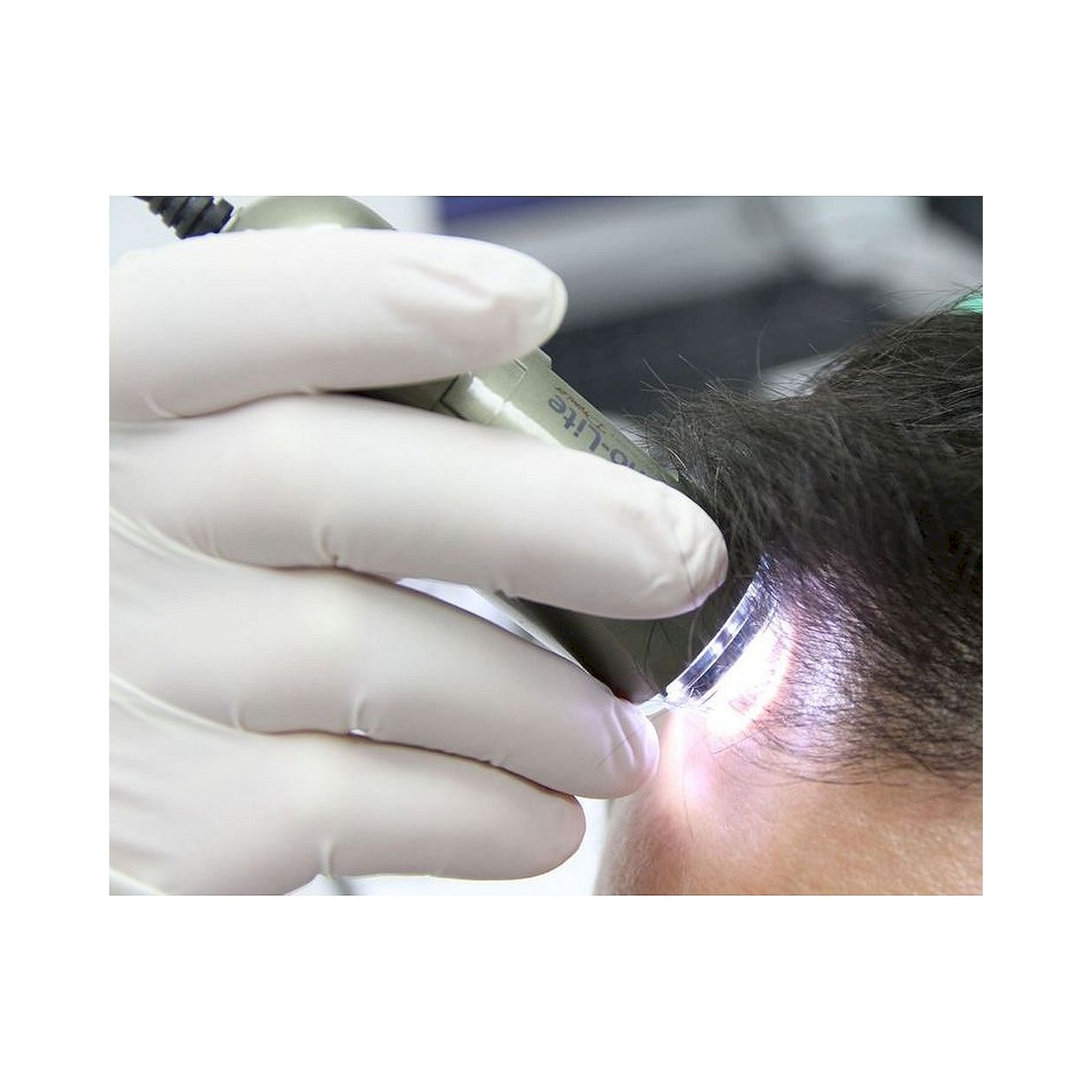 Dino-Lite TrichoScope UV