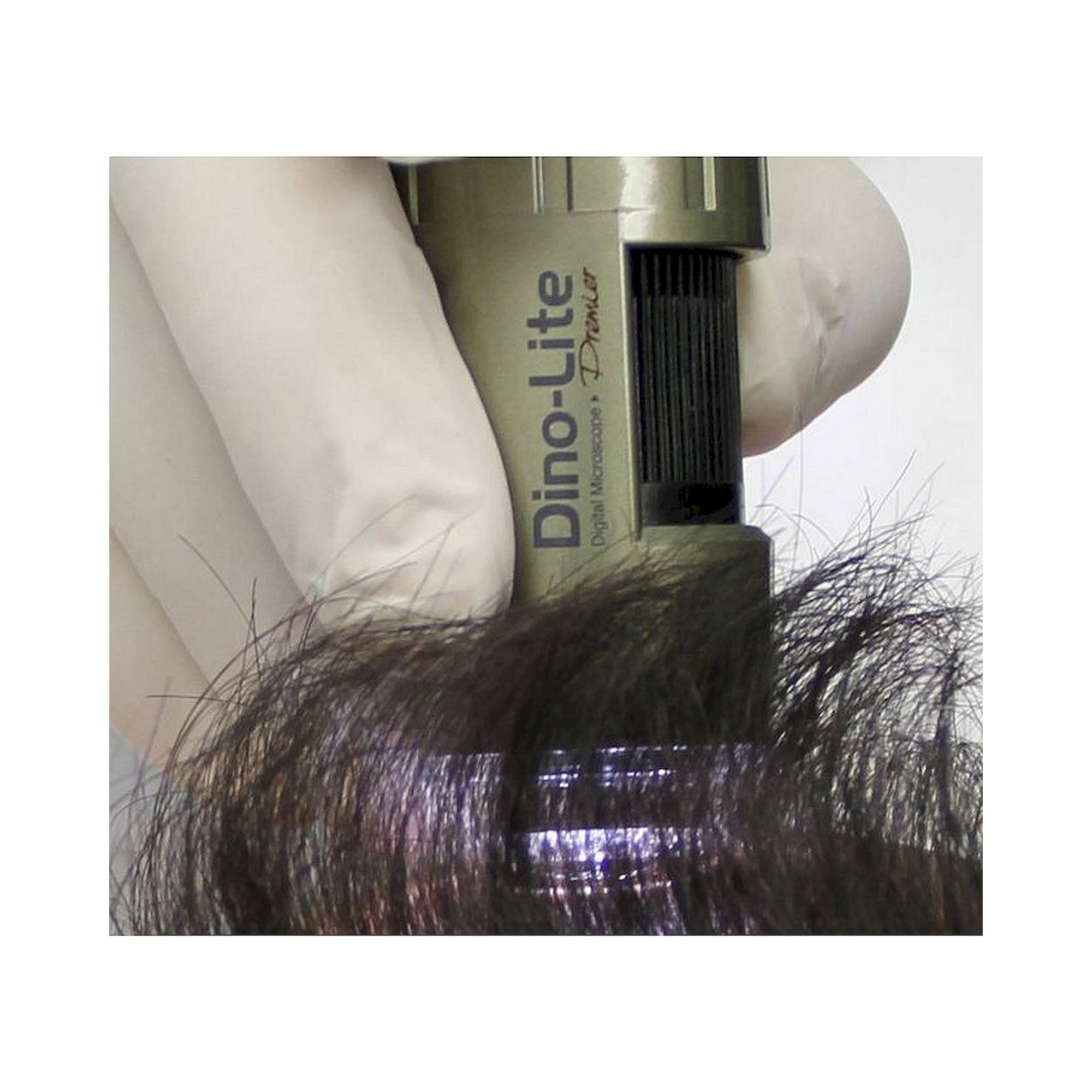 Caméra trichoscope USB 1,3 MP jusqu'à 200x avec éclairage UV trichoscopie - Dino-Lite TrichoScope UV