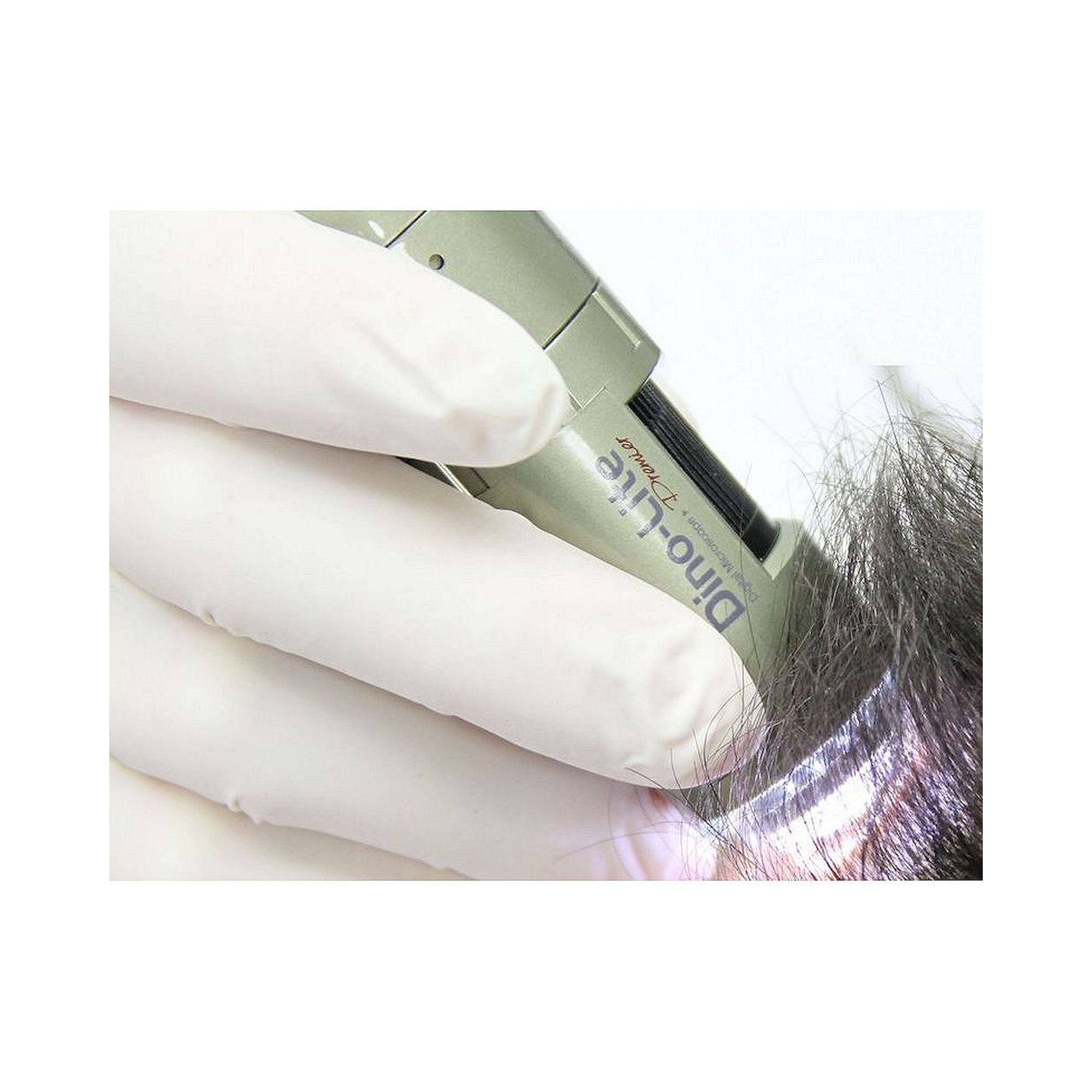 Caméra trichoscope USB 1,3 MP jusqu'à 200x avec éclairage UV trichoscopie - Dino-Lite TrichoScope UV